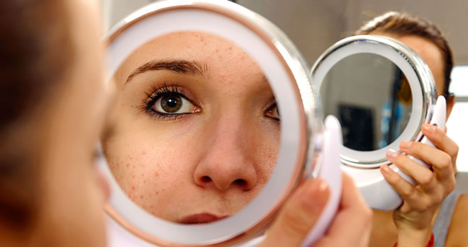 7 Amazing Skin Benefits of Buttermilk